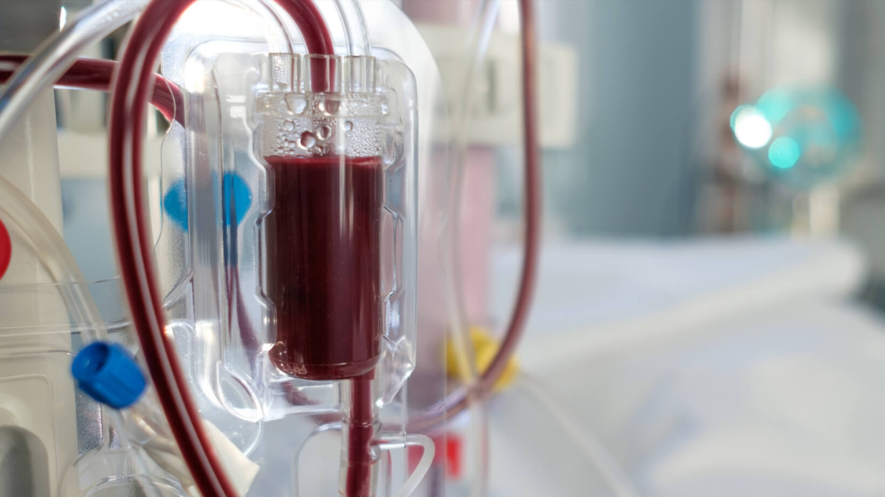 Secretaria de saúde está ampliando a oferta de vagas para sessões de hemodiálise